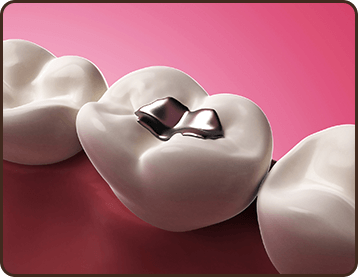 Restorative Dentistry